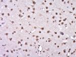 Phospho-KAT5 (Ser86) Antibody in Immunohistochemistry (Paraffin) (IHC (P))