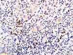 pan Cytokeratin Antibody in Immunohistochemistry (Paraffin) (IHC (P))