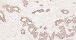 pan Cytokeratin Antibody in Immunohistochemistry (Paraffin) (IHC (P))