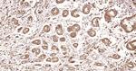 pan Cytokeratin Antibody in Immunohistochemistry (Paraffin) (IHC (P))