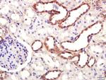 DAT/Dopamine transporter Antibody in Immunohistochemistry (Paraffin) (IHC (P))