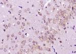 DAT/Dopamine transporter Antibody in Immunohistochemistry (Paraffin) (IHC (P))