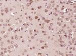 TPA Antibody in Immunohistochemistry (Paraffin) (IHC (P))