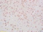 Phospho-TPH2 (Ser19) Antibody in Immunohistochemistry (Paraffin) (IHC (P))