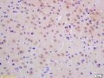 dUTPase Antibody in Immunohistochemistry (Paraffin) (IHC (P))