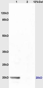 dUTPase Antibody in Western Blot (WB)