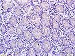 Phospho-c-Met (Tyr1365) Antibody in Immunohistochemistry (Paraffin) (IHC (P))