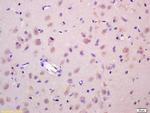 Wnt1 Antibody in Immunohistochemistry (Paraffin) (IHC (P))