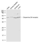 DRD4 Antibody in Western Blot (WB)