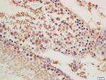 ORP1 Antibody in Immunohistochemistry (Paraffin) (IHC (P))