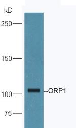 ORP1 Antibody in Western Blot (WB)