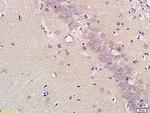 EAAT2 Antibody in Immunohistochemistry (Paraffin) (IHC (P))