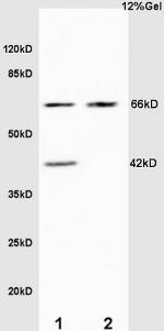 Elastin Antibody in Western Blot (WB)