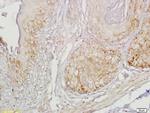 Gastrin receptor/GASR/CCKBR Antibody in Immunohistochemistry (Paraffin) (IHC (P))