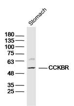 Gastrin receptor/GASR/CCKBR Antibody in Western Blot (WB)