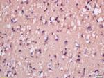 MSRB2 Antibody in Immunohistochemistry (Paraffin) (IHC (P))