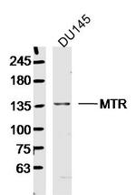 MTR Antibody in Western Blot (WB)