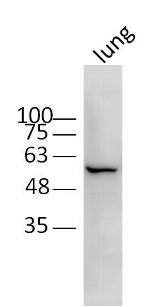 CRMP2 Antibody in Western Blot (WB)