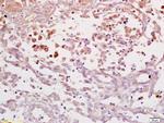 IL-6R alpha Antibody in Immunohistochemistry (Paraffin) (IHC (P))