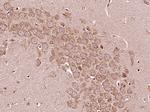 IL-6R alpha Antibody in Immunohistochemistry (Paraffin) (IHC (P))