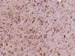 Phospho-IKB alpha (Ser36) Antibody in Immunohistochemistry (Paraffin) (IHC (P))