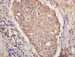 IRF9 Antibody in Immunohistochemistry (Paraffin) (IHC (P))