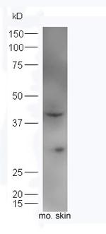 IL34 Antibody in Western Blot (WB)