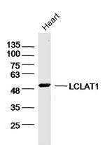 LCLAT1 Antibody in Western Blot (WB)