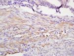 IGFBP1 Antibody in Immunohistochemistry (Paraffin) (IHC (P))