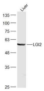 LGI2 Antibody in Western Blot (WB)