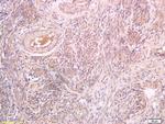 Pro-Inhibin beta B Antibody in Immunohistochemistry (Paraffin) (IHC (P))