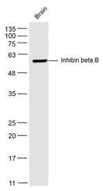 Pro-Inhibin beta B Antibody in Western Blot (WB)