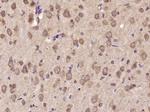 IL-11 Antibody in Immunohistochemistry (Paraffin) (IHC (P))