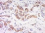 LIN9 Antibody in Immunohistochemistry (Paraffin) (IHC (P))