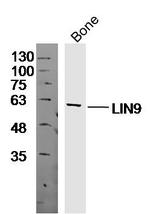 LIN9 Antibody in Western Blot (WB)