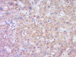 LIPC Antibody in Immunohistochemistry (Paraffin) (IHC (P))