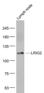 LRIG2 Antibody in Western Blot (WB)