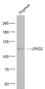 LRIG2 Antibody in Western Blot (WB)