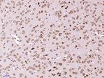 NR3C2/Mineralocorticoid receptor Antibody in Immunohistochemistry (Paraffin) (IHC (P))