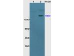 NR3C2/Mineralocorticoid receptor Antibody in Western Blot (WB)