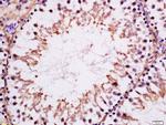 MAK Antibody in Immunohistochemistry (Paraffin) (IHC (P))