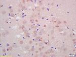 PARK2 Antibody in Immunohistochemistry (Paraffin) (IHC (P))