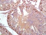 PARK2 Antibody in Immunohistochemistry (Paraffin) (IHC (P))