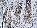 PDL2/B7-DC Antibody in Immunohistochemistry (Paraffin) (IHC (P))