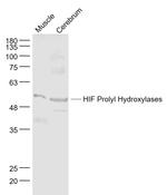 P4HTM Antibody in Western Blot (WB)