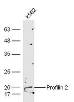 Profilin 2 Antibody in Western Blot (WB)