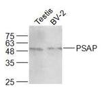 PSAP/PAP Antibody in Western Blot (WB)