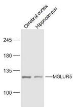 MGLUR5 Antibody in Western Blot (WB)