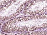 Securin/PTTG Antibody in Immunohistochemistry (Paraffin) (IHC (P))