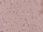 Securin/PTTG Antibody in Immunohistochemistry (Paraffin) (IHC (P))